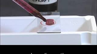 Staining technique in microbiology Acid fast staining [upl. by Llirret]