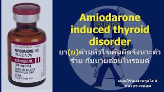 Amiodarone induced thyroid disorders [upl. by Abixah]