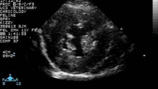 Feline Hypertrophic Cardiomyopathy  Cross Section [upl. by Robet]