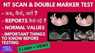 What is NT scan and Double Marker test in pregnancy  Reports kaise samjhein [upl. by Barrus55]