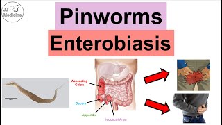 Pinworms Enterobiasis  Infection Transmission Symptoms Diagnosis Treatment [upl. by Eimyaj]