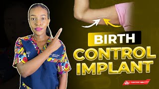 Contraceptive Implant The implant birth control side effects [upl. by Oihsoy444]