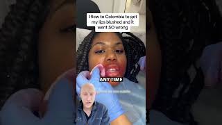 Lip Blushing GONE WRONG  Plastic Surgeon Reacts [upl. by Steele967]