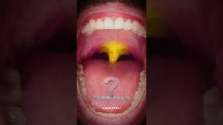 Your Oral Health Affects Your Entire Body Mouth Bell [upl. by Nerat]