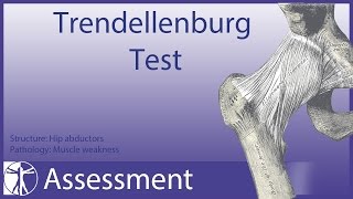 Trendelenburg Test  Hip Abductor Weakness [upl. by Levi647]