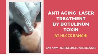 Anti Aging Laser Treatment By Botulinum Toxin at HLCCS RANCHICall now 9334334935 laser skincare [upl. by Haorbed173]