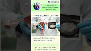 Diagnosis amp treatment of uterine fibroid doctor [upl. by Larkins]