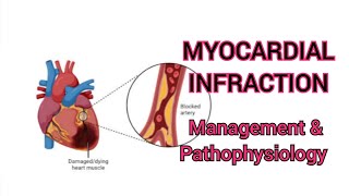 PATHOPHYSIOLOGY OF MYOCARDIAL INFRACTION [upl. by Niloc849]