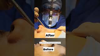 Anesthesia Myths amp Facts for Surgery  Plastic Surgery Podcast  Dr Rajat Gupta  RG Aesthetics [upl. by Yaluz]