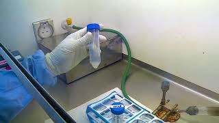 10 Demonstration of processing of sputum specimen for culture for diagnosis of tuberculosis [upl. by Paik]