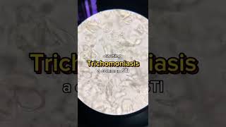 Trichomonas vaginalis 😲 urine microbiology parasite lab laboratory analysis [upl. by Airotkciv572]