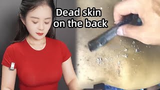 💈ASMR  Remove a lot of dead skin from a mans back 🪒 Skillful face wet shaving [upl. by Aydan193]