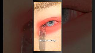 What Causes Pink Eye  The Surprising Truth facts ayurveda [upl. by Palgrave]