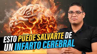 ESTO PUEDE SALVARTE DE UN INFARTO CEREBRAL [upl. by Ailedamla]