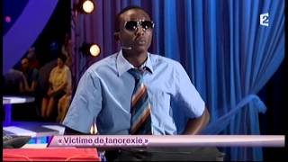 Ahmed Sylla 16 Victime de tanorexie  ONDAR [upl. by Nosnibor]