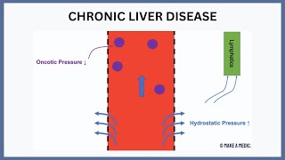 Chronic Liver Disease Explained [upl. by Nniroc]