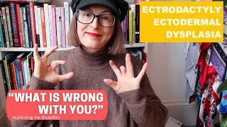 My Disability  EEC Syndrome  Ectodermal Dysplasia [upl. by Bouldon774]