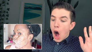 Specialist Reacts to DIY Chemical Peels [upl. by Armando]