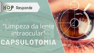 Capsulotomia quotlimpeza da lente intraocularquot [upl. by Carita201]