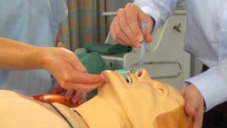 Using a Nasopharyngeal Airway [upl. by Roberta735]