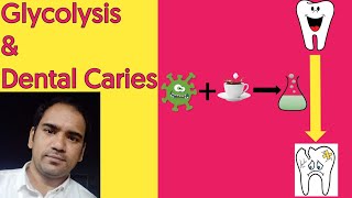 Dental Caries amp Glycolysis Biochemistry What is Dental plaque  How Bacteria cause Caries [upl. by Allebasi]