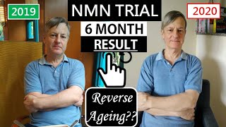 NMN Resveratrol Trial Six Months Result  Reverse Aging [upl. by Latrell]