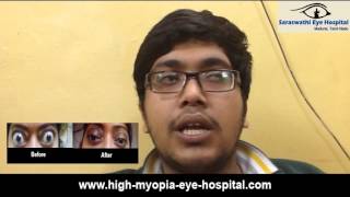 Thyroid Eye Problems Bulging Eye Treatment Tamilnadu [upl. by Mintz]