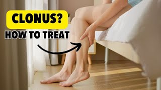 What the Heck is Clonus And Can I do Anything About It [upl. by Nerret]