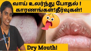 வாய் அடிக்கடி உலர்ந்து போகும் பிரச்சனை காரணங்கள் தீர்வுகள்Dry mouth reasons and solutions in tamil [upl. by Ursulette368]