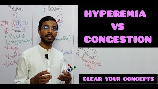 HYPEREMIA VS CONGESTION medicalpathologyhyperemiacongestion [upl. by Asilrak]