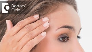 Is Povidone Iodine solution helpful in treating acne  Dr Sudheendra Udbalker [upl. by Honig]