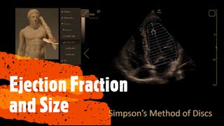 Measure Ejection Fraction EF and Ventricle Size Perioperative amp Critical Care ECHO  POCUS [upl. by Adnih]