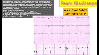 Mount Sinai Pediatric EP Conference 4824 [upl. by Dunc]