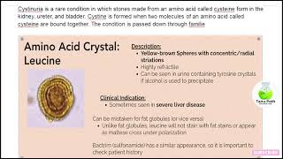 amino acid crystal in urine  Tanu Path [upl. by Puritan]