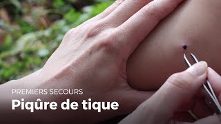 Premiers secours  Piqure de tique  Secourisme [upl. by Atrice]