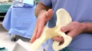 Advances in Hip Replacement Surgery [upl. by Nilyahs]