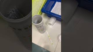 Urine Dipstick Test in Hospital Laboratory [upl. by Stinky]