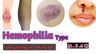 Hemophilia  Hemophilia types  Hemophilia A  Hemophilia B Hemophilia C Doctors goal [upl. by Chancellor]