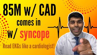 85M with CAD and prior coronary stenting comes in with syncope Check out this EKG [upl. by Adlig130]