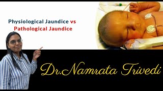 Pathological amp Physiological jaundice Difference [upl. by Atwater]