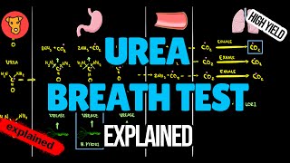 UREA BREATH TEST for Helicobacter Pylori Explained [upl. by Avuha792]