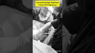 Cervical Cerclage Procedure for twin IVF pregnancy by Dr Rakshita Malik ivf pregnancy twins [upl. by Hoppe]