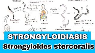 Strongyloidiasis  Life cycle Symptoms Treatment  Strongyloides stercoralis  Bio science [upl. by Ecylahs]