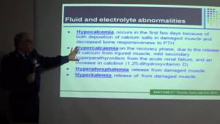 Rhabdomyolysis Prof Khaled Eweeda Air Force Specialized Hospital [upl. by Jsandye]