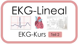 EKG Lineal richtig verwenden  Praktische Tipps Frequenz Lagetyp Zeiten Fallbeispiel [upl. by Haleemaj]