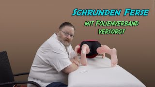 Schrunden Ferse mit Folienverband versorgt [upl. by Uticas38]