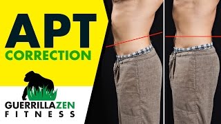 Anterior Pelvic Tilt Before and After [upl. by Abroms]