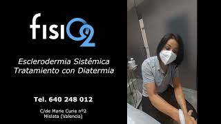 Esclerodermia sistémica tratamiento con diatermia [upl. by Suu]