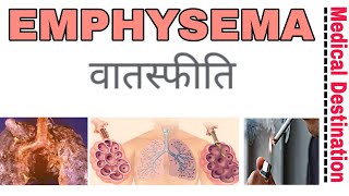 Emphysema in Hindi symptoms  causes and treatment Medical destination [upl. by Ydaf318]