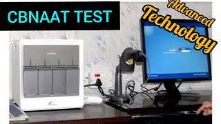 CBNAAT Test ProcedureCartridge Based Nucleic Acid Amplification Test TB Detectionthemedilab [upl. by Schroer]